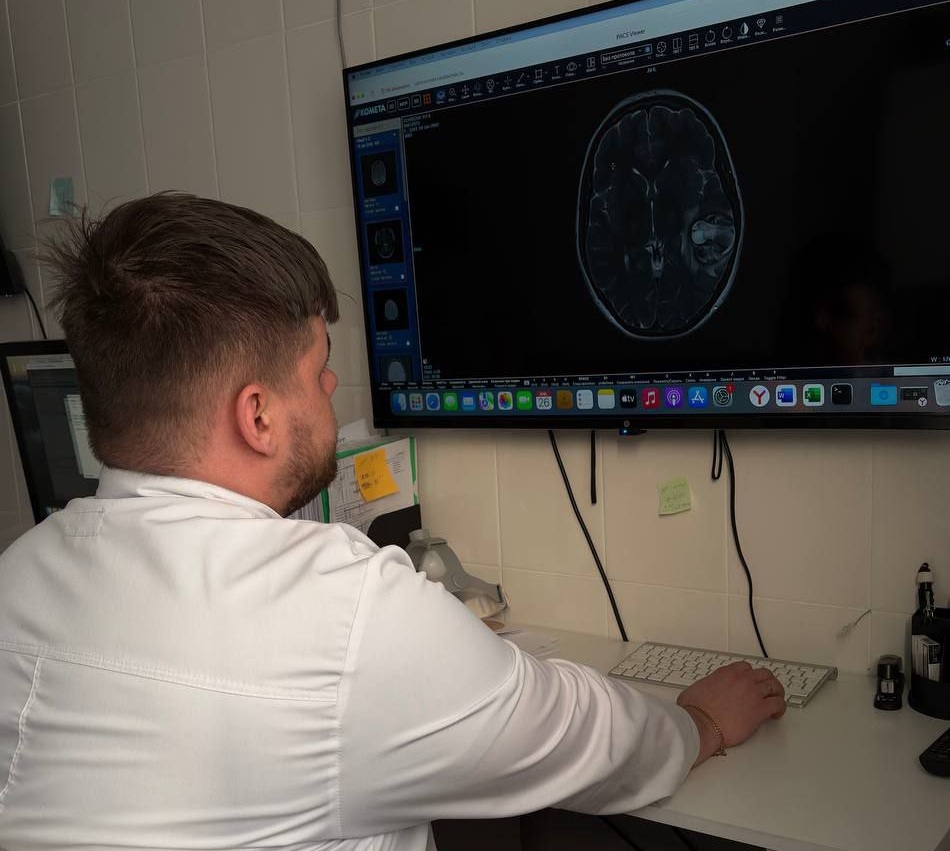 Саратовские врачи спасли 24-летнюю девушку с опухолью мозга